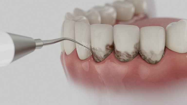 Reliable Teeth Cleaning And Checkup contractor in Page County County, VA by Dentist Open Now